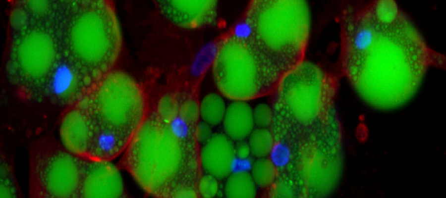 Pig fat cells